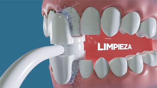 Limpieza de placa de los dientes